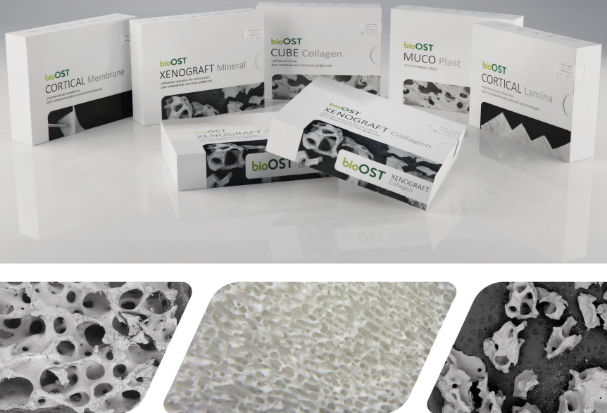Мембрана длительной резорбции, костный материал Биоматериалы серии bioOST, bioPLATE и FibroMATRIX применяются в челюстно-лицевой хирургии, хирургической стоматологии, имплантологии, пародонтологии для направленной тканевой регенерации, восполнения дефектов и регенерации костной ткани, мягких тканей, слизистой различной этиологии и локализации.